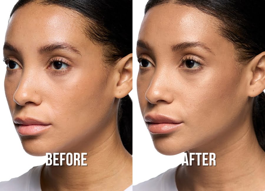 lips-before-after-1-img